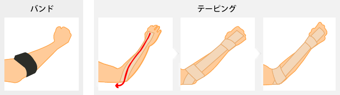 野球 肘 テーピング