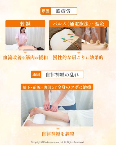 肩こりの治療