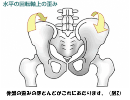 骨盤のゆがみ